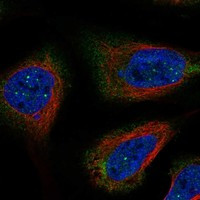 RNF32 Antibody in Immunocytochemistry (ICC/IF)