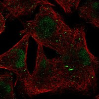 BTBD1 Antibody in Immunocytochemistry (ICC/IF)