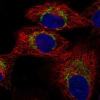 TRMT61A Antibody in Immunocytochemistry (ICC/IF)