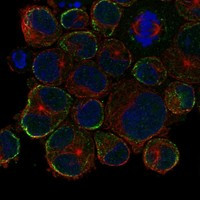 KRT35 Antibody in Immunocytochemistry (ICC/IF)