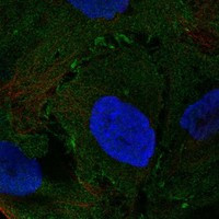NMUR2 Antibody in Immunocytochemistry (ICC/IF)