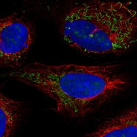 BCKDHB Antibody in Immunocytochemistry (ICC/IF)