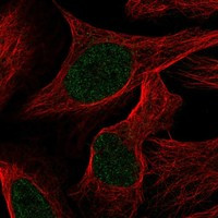 TRAPPC12 Antibody in Immunocytochemistry (ICC/IF)