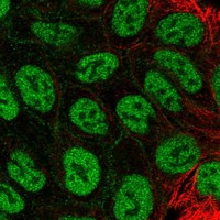 MFAP3L Antibody in Immunocytochemistry (ICC/IF)