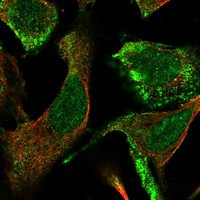 CLCA4 Antibody in Immunocytochemistry (ICC/IF)