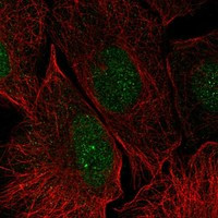 Galectin 14 Antibody in Immunocytochemistry (ICC/IF)
