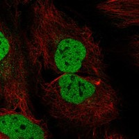 WAPL Antibody in Immunocytochemistry (ICC/IF)