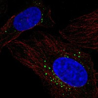 PRCP Antibody in Immunocytochemistry (ICC/IF)