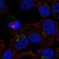 TRPM1 Antibody in Immunocytochemistry (ICC/IF)