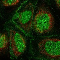 PLA1 Antibody in Immunocytochemistry (ICC/IF)