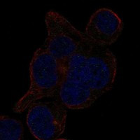 LRRCC1 Antibody in Immunocytochemistry (ICC/IF)