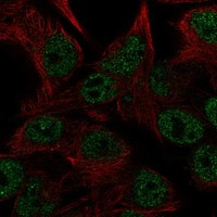 CEMP1 Antibody in Immunocytochemistry (ICC/IF)