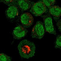 MEFV Antibody in Immunocytochemistry (ICC/IF)