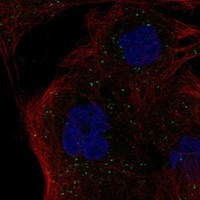 HLA-DMB Antibody in Immunocytochemistry (ICC/IF)