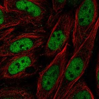 ZNF843 Antibody in Immunocytochemistry (ICC/IF)
