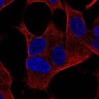 ZCCHC18 Antibody in Immunocytochemistry (ICC/IF)