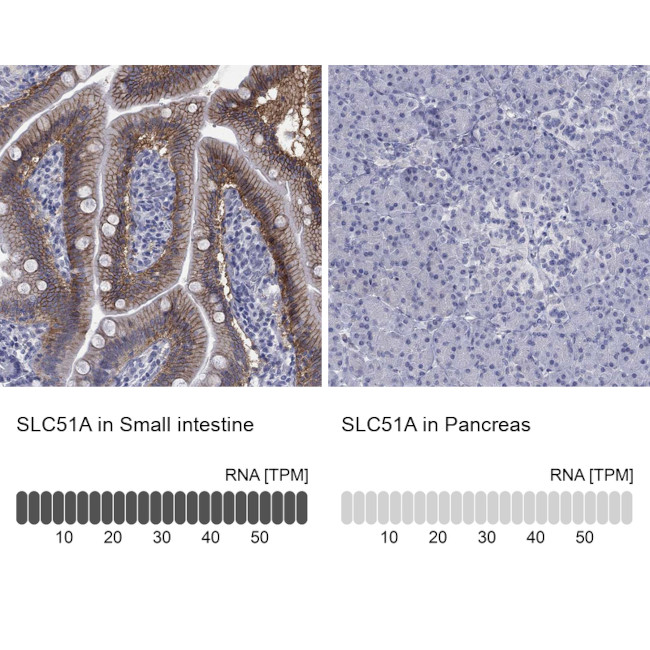 SLC51A Antibody in Immunohistochemistry (Paraffin) (IHC (P))