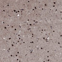 PRICKLE4 Antibody in Immunohistochemistry (Paraffin) (IHC (P))