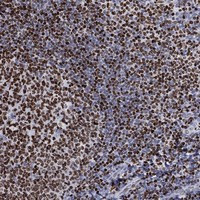 Histone H1.5 Antibody in Immunohistochemistry (Paraffin) (IHC (P))