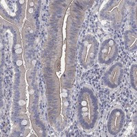 TMEM198 Antibody in Immunohistochemistry (Paraffin) (IHC (P))