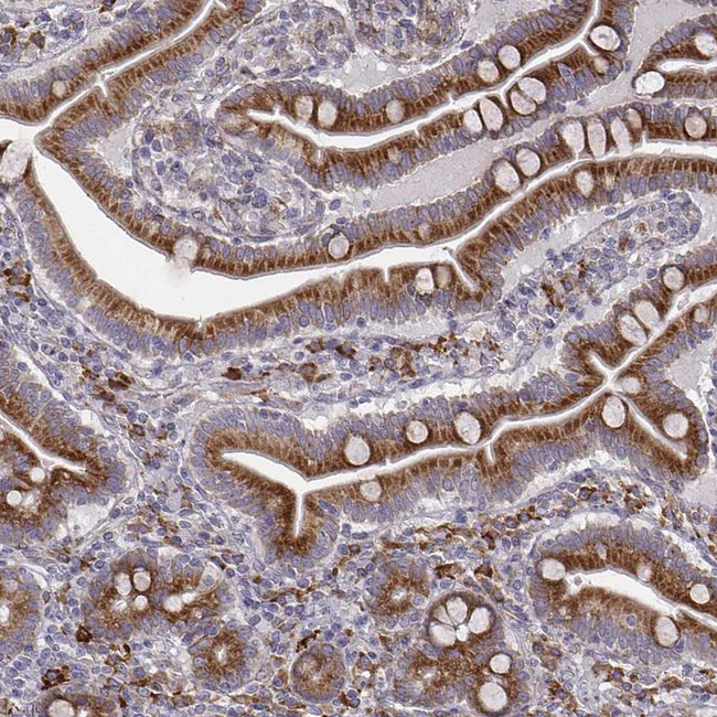 Seli Antibody in Immunohistochemistry (Paraffin) (IHC (P))