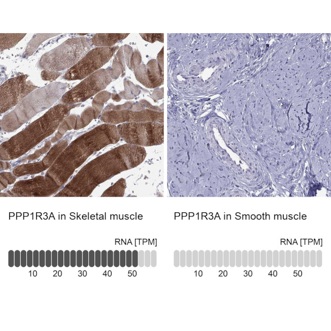 PPP1R3A Antibody in Immunohistochemistry (Paraffin) (IHC (P))