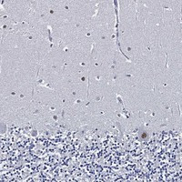 SKOR1 Antibody in Immunohistochemistry (Paraffin) (IHC (P))