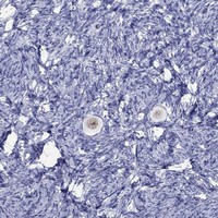 Figla Antibody in Immunohistochemistry (Paraffin) (IHC (P))