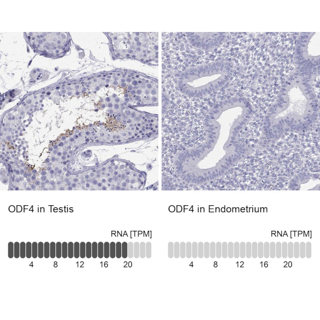 ODF4 Antibody in Immunohistochemistry (Paraffin) (IHC (P))