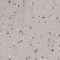 E4F1 Antibody in Immunohistochemistry (Paraffin) (IHC (P))