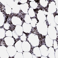 HIAT1 Antibody in Immunohistochemistry (Paraffin) (IHC (P))