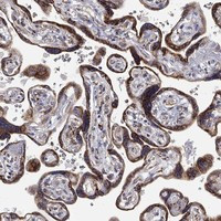 GATSL3 Antibody in Immunohistochemistry (Paraffin) (IHC (P))