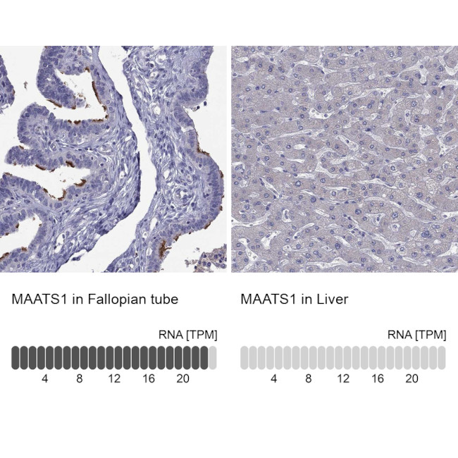 CFAP91 Antibody in Immunohistochemistry (Paraffin) (IHC (P))