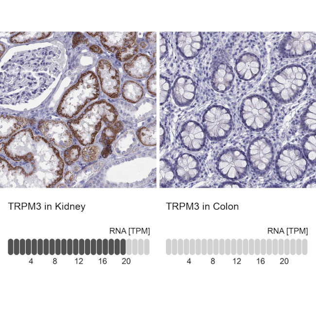 TRPM3 Antibody in Immunohistochemistry (Paraffin) (IHC (P))