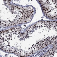 EHMT1 Antibody in Immunohistochemistry (Paraffin) (IHC (P))