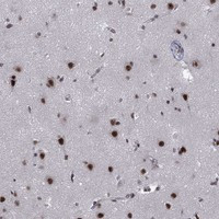 FYTTD1 Antibody in Immunohistochemistry (Paraffin) (IHC (P))