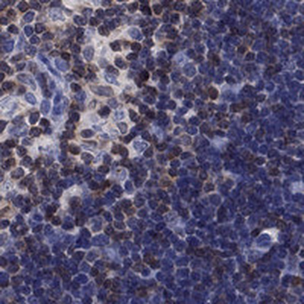 LIMD2 Antibody in Immunohistochemistry (Paraffin) (IHC (P))