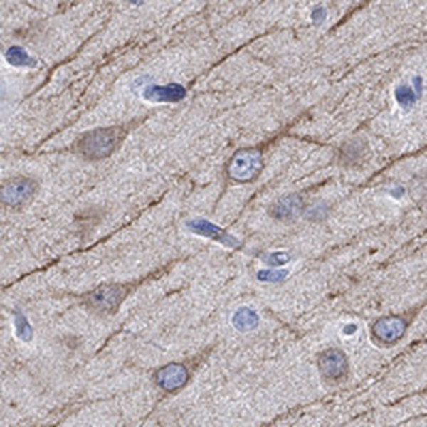 CAMK2N2 Antibody in Immunohistochemistry (Paraffin) (IHC (P))