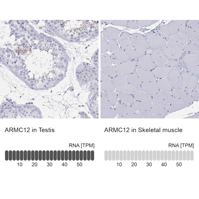 ARMC12 Antibody in Immunohistochemistry (Paraffin) (IHC (P))
