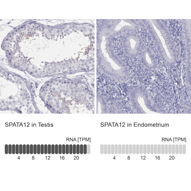 SPATA12 Antibody in Immunohistochemistry (Paraffin) (IHC (P))