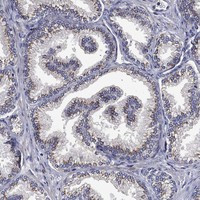 FRG1 Antibody in Immunohistochemistry (Paraffin) (IHC (P))