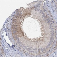 PMFBP1 Antibody in Immunohistochemistry (Paraffin) (IHC (P))