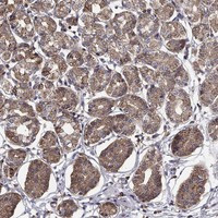 ALG6 Antibody in Immunohistochemistry (Paraffin) (IHC (P))