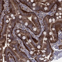 eIF4E3 Antibody in Immunohistochemistry (Paraffin) (IHC (P))