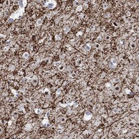 RIM1 Antibody in Immunohistochemistry (Paraffin) (IHC (P))