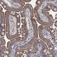 ERN2 Antibody in Immunohistochemistry (Paraffin) (IHC (P))