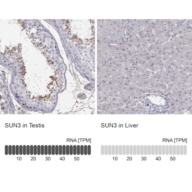 SUN3 Antibody in Immunohistochemistry (Paraffin) (IHC (P))