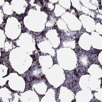 RHCE Antibody in Immunohistochemistry (Paraffin) (IHC (P))