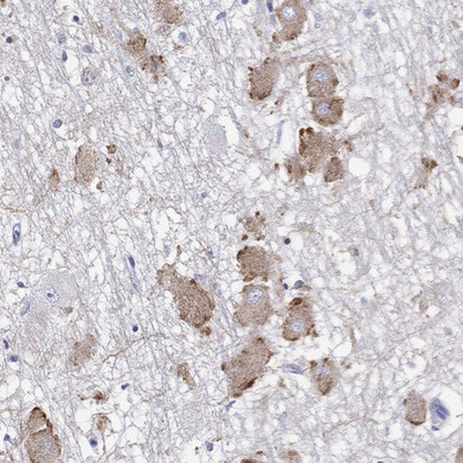 ECEL1 Antibody in Immunohistochemistry (Paraffin) (IHC (P))