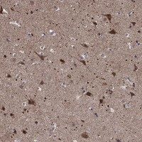 ZNF594 Antibody in Immunohistochemistry (Paraffin) (IHC (P))